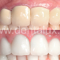 Dent-A-Lux Fogászat, fogorvos, Kecskemét, mosolytervezés