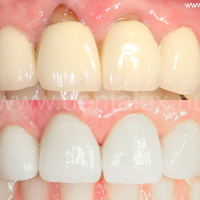 Dent-A-Lux Fogászat, fogorvos, fogászat, fogbeültetés, fogimplantátum, Kecskemét