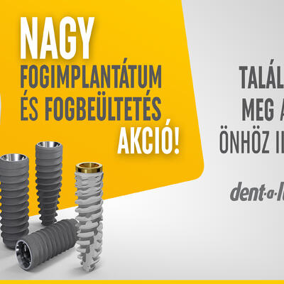 Dent-A-Lux - Fogimplantátum és Fogbeültetés Akció Kecskeméten