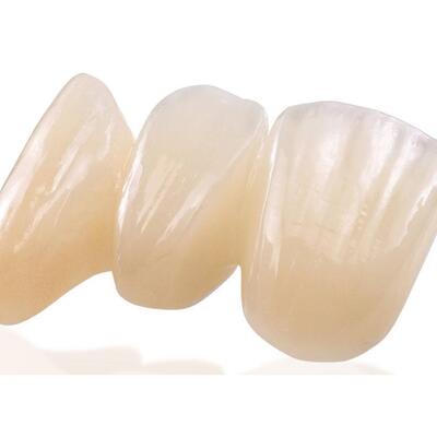 Dent-A-Lux - Cirkon - Kinek ajánlható (1. rész)