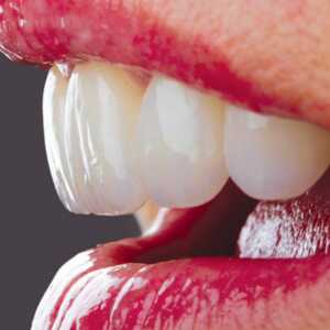 Dent-A-Lux Fogászat Kecskemét