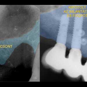 Dent-A-Lux Fogászat Kecskemét