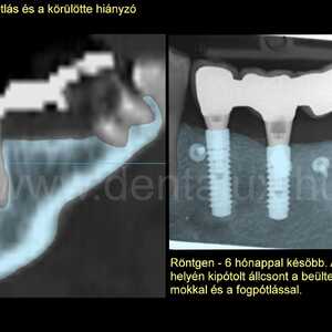 Dent-A-Lux Fogászat Kecskemét