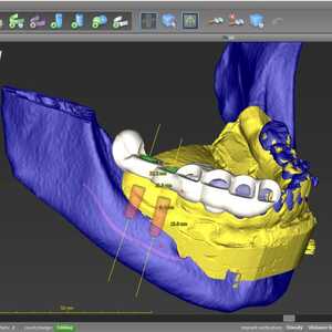 Dent-A-Lux Fogászat Kecskemét