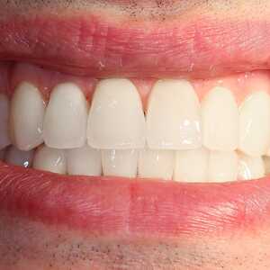 Dent-A-Lux Fogászat Kecskemét