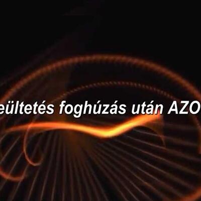 Dent-A-Lux - Fogbeültetés, fogimplantátum foghúzás után AZONNAL