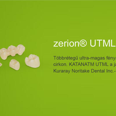 Dent-A-Lux - Lépjen egy szinttel feljebb velünk!