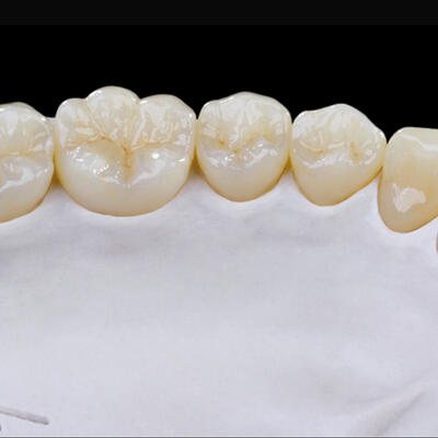 Dent-A-Lux - Cirkon korona és fogpótlás -az új generáció.