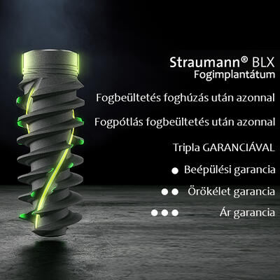 Dent-A-Lux - Foghúzás után fogbeültetést, fogat szeretne azonnal? ÍME!