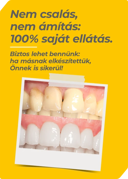Egyedi, valós fogpótlások a Dentalux kecskeméti fogtechnikai laborjából