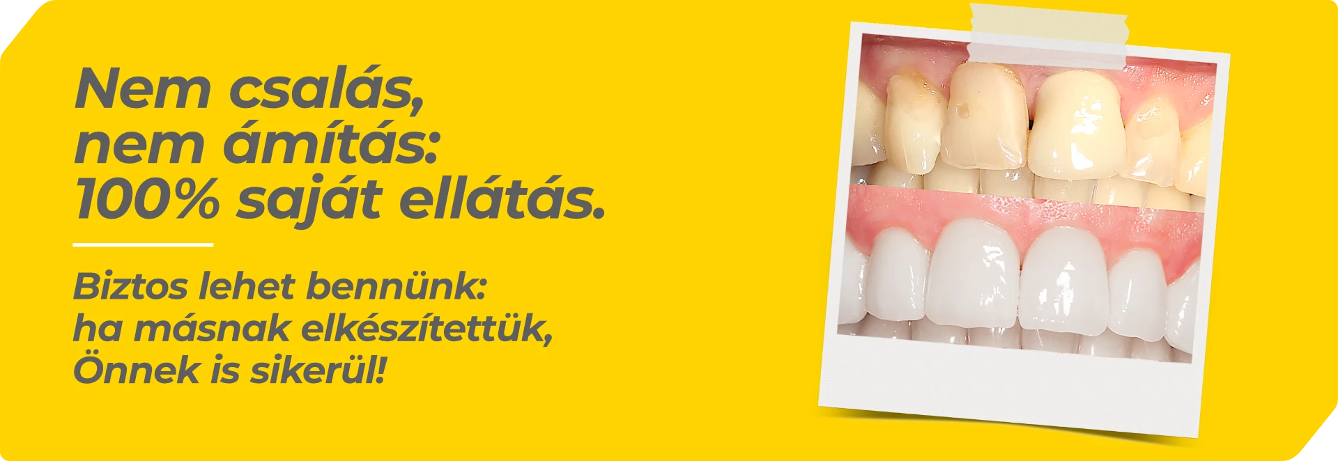 Egyedi, valós fogpótlások a Dentalux kecskeméti fogtechnikai laborjából