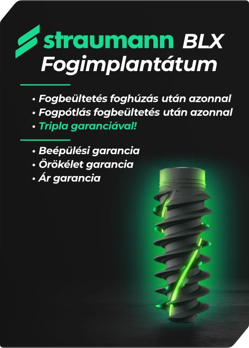 Straumann BLX fogimplantátum tripla garanciával a Dentaluxnál: beépülési, örökélet és árgarancia