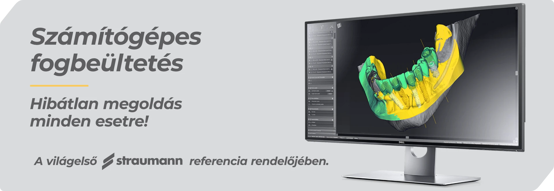 Számítógépes fogbeültetés a Straumann referencia rendelőjében, a Dentalux Fogászaton